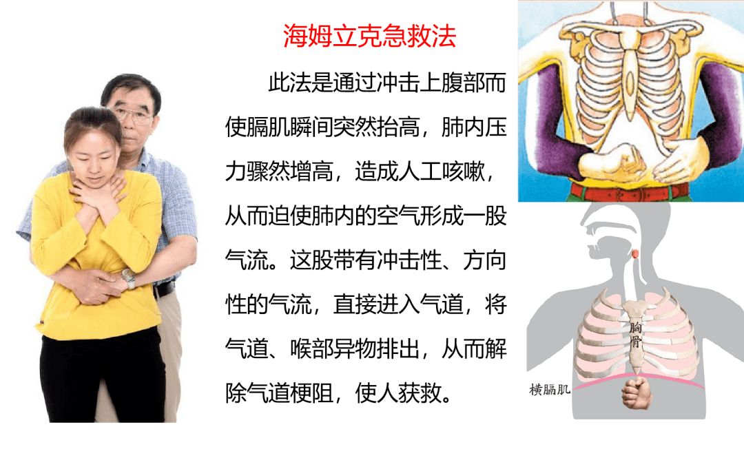 海姆克急救法，每個(gè)家長(zhǎng)都應(yīng)該學(xué)會(huì)的急救方法！