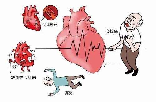 記住4個(gè)急救“黃金時(shí)間”，關(guān)鍵時(shí)候能夠救命