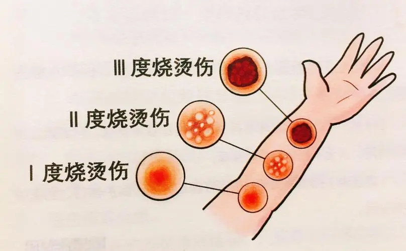 面對火災，應該如何自救？